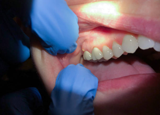 Best Emergency Root Canal Treatment in Seward, AK